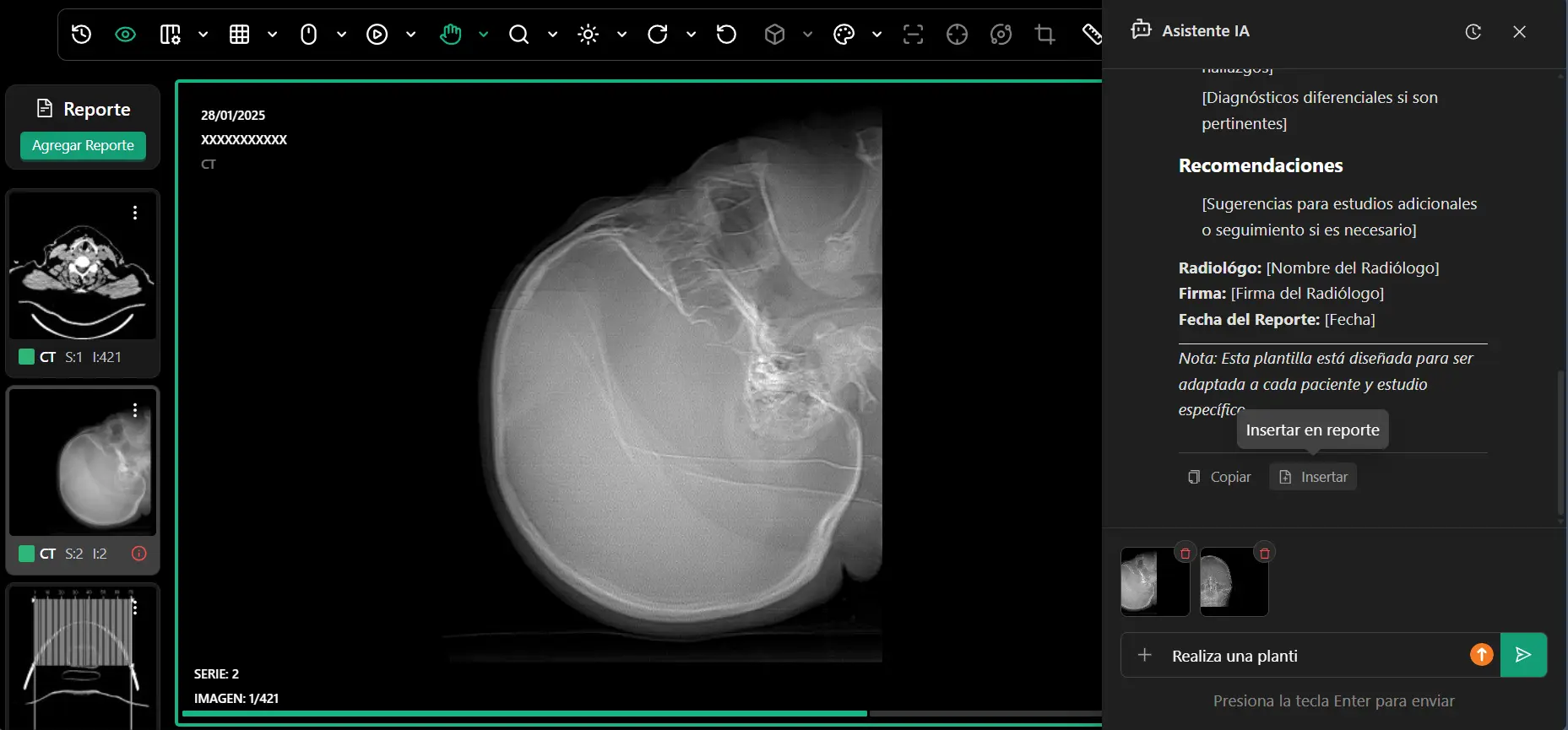 Asistente de Informes