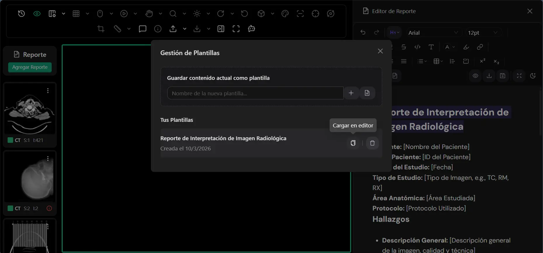 Plantillas Personalizadas