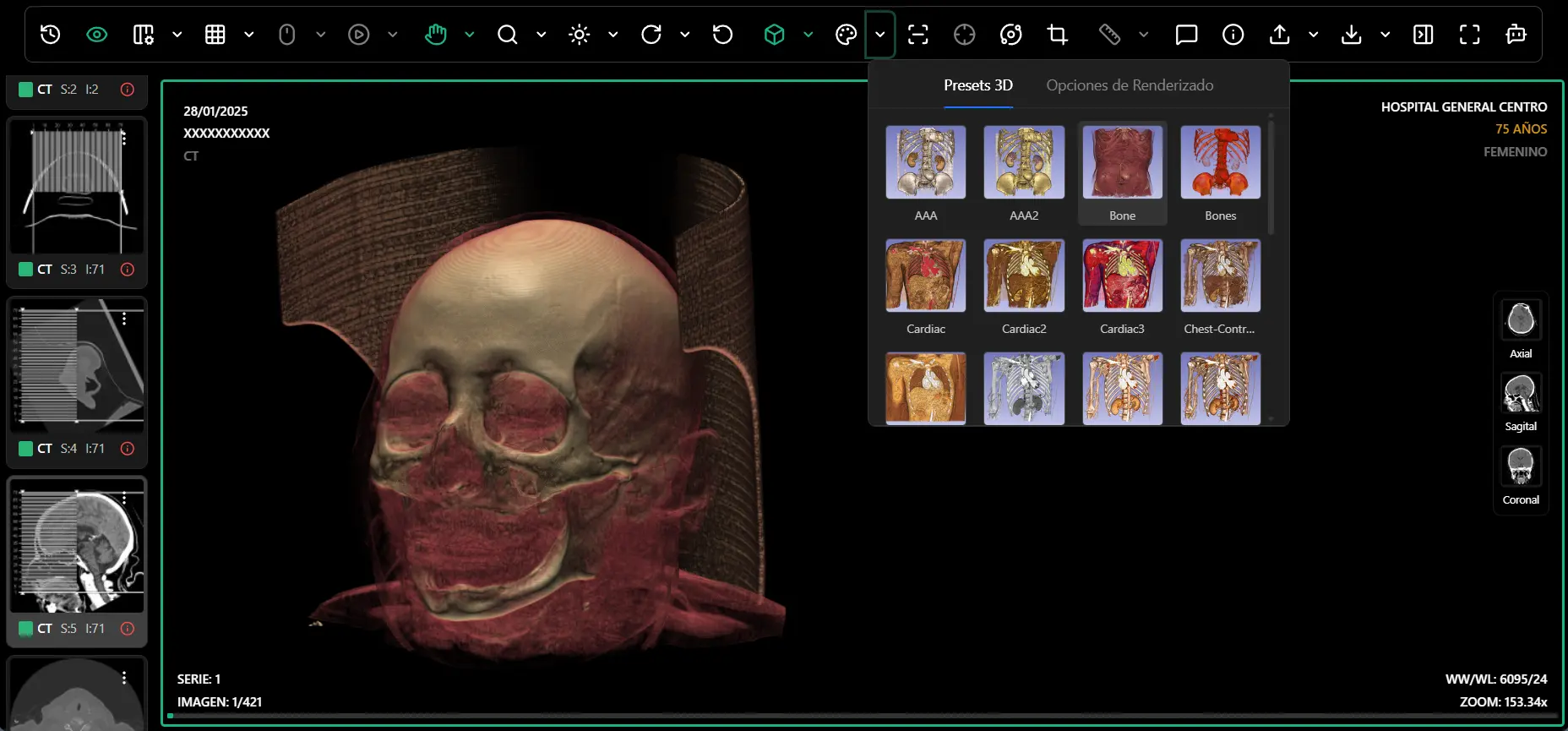 Cortes y Segmentación