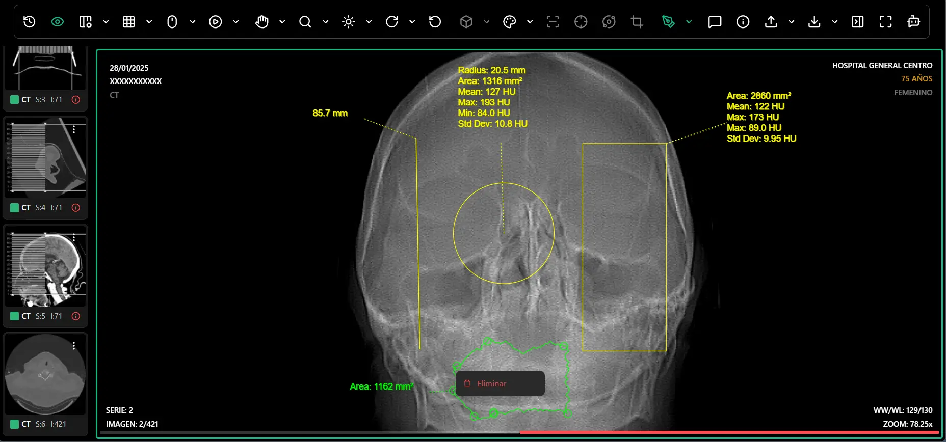 Herramientas de Medición